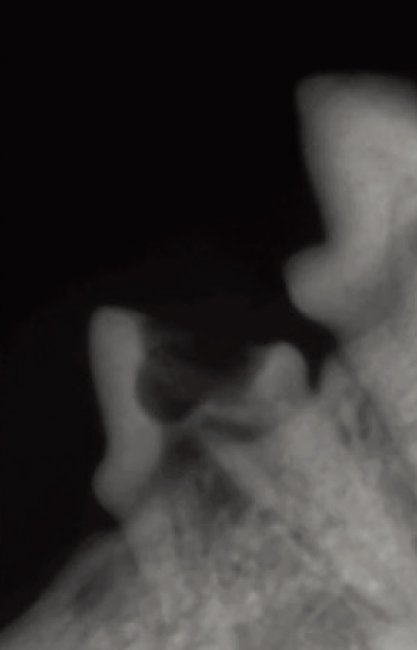 고양이의 치아 엑스레이 사진. [사진 제공 · 이영수]