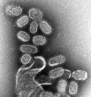 독감 바이러스 현미경 사진 [출처: 미국 질병예방통제센터(CDC)]