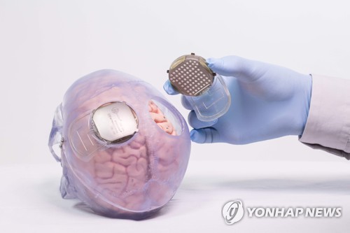 '티보'의 뇌와 피부 사이에 심어진 기록장치 [AFP=연합뉴스]