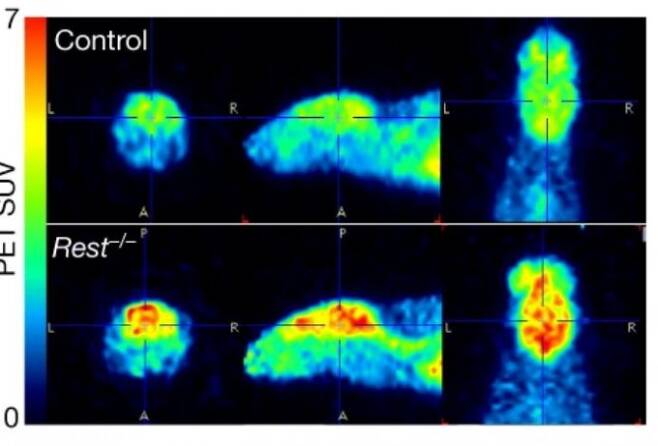 Rest 유전자가 고장난 생쥐(아래)는 정상 생쥐(위)에 비해 뇌의 전반적인 신경 활동이 더 활발하다. REST가 있어야 신경 활동이 통제를 받는다는 말이다. 빨간색으로 갈수록 활동이 크고 파란색으로 갈수록 작다. 네이처 제공