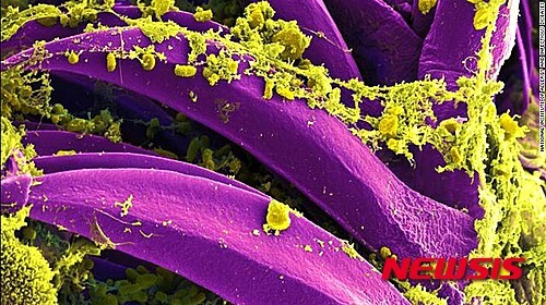【서울=뉴시스】쥐벼룩을 매개로 전염되는  페스트균의 사진.  (사진 출처: CNN 인터넷판) 2015.08.25