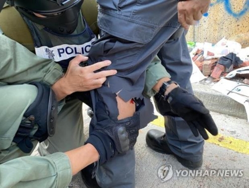 시위대가 쏜 화살에 다리를 맞은 홍콩 경찰 [AFP통신=연합뉴스]