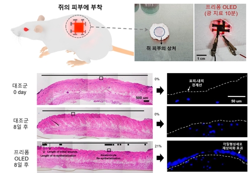 각질형성세포를 제거한 실험쥐에 '프리폼 OLED'를 부착한 결과 세포가 재생된 모습 [한국연구재단 제공. 재판매 및 DB 금지]