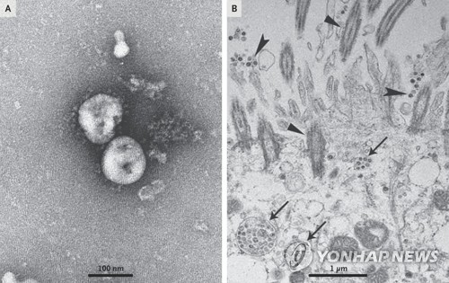 배양된 신종 코로나바이러스를 광학현미경으로 관찰한 모습 [NEJM 논문 발췌]