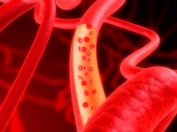 올바른 생활습관 실천만으로도 심혈관질환의 75%는 예방할 수 있다./사진=클립아트코리아