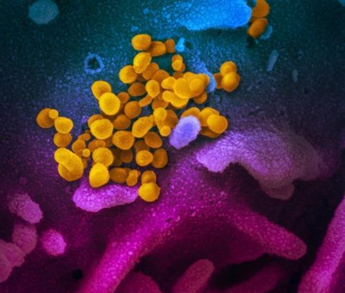 신종 코로나바이러스 신종 코로나바이러스(노란색)가 세포 표면(청색·분홍색)에 몰려있다. 미국 확진자의 검체를 실험실에서 배양해 전자현미경으로 관찰한 것이다.  [미 NIH 국립 알레르기 감염병 연구소 제공]
