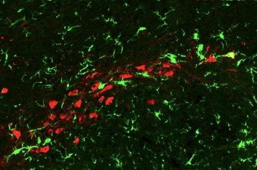 행복감을 주는 도파민 도파민 호르몬을 분비하는 뇌 신경세포(적색)가 노화하면 소교세포(녹색)의 공격을 받는다.   [미 록펠러대 분자·세포 신경학 랩 제공]
