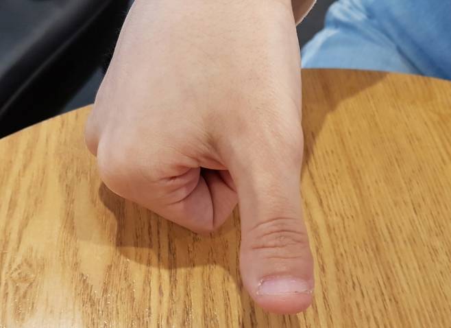 빅터 우튼을 연상케 하는 정효림의 오른손 엄지.