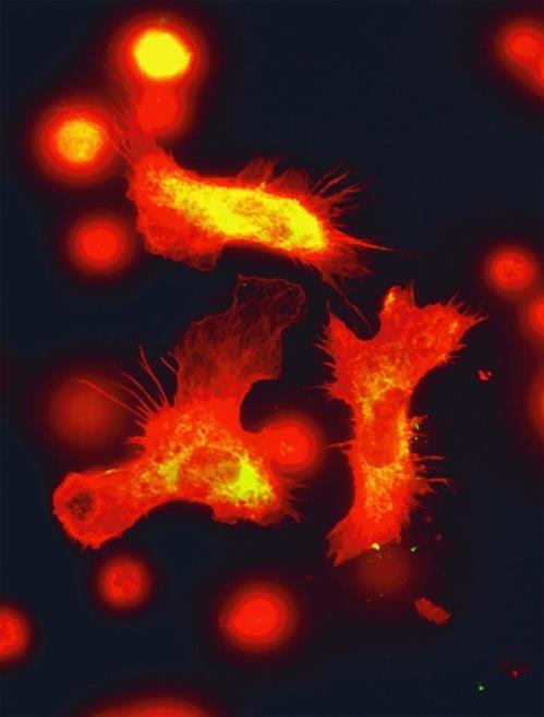 조혈모세포의 현미경 이미지 [독일 드레스덴 공대 제공 / 재판매 및 DB 금지]