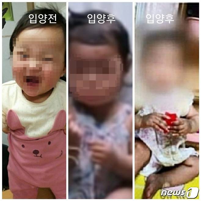 생후 16개월 영아가 사망한 사건과 관련, 입양 전(왼쪽)과 입양 후(가운데, 오른쪽) 모습이 담긴 사진이 공개됐다. 2020.11.17/뉴스1 © 뉴스1