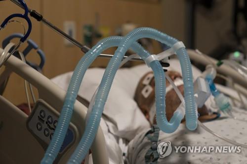 미 캘리포니아주 로스앤젤레스의 프로비던스 홀리크로스 의료센터에서 한 코로나19 환자가 인공호흡기를 부착한 채 치료받고 있다. [AP=연합뉴스 자료사진]
