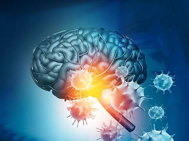 코로나19 바이러스 면역계 교란시켜 뇌신경계 간접 공격한다 - 코로나19로 사망한 사람들의 뇌 조직을 분석한 결과 코로나19 바이러스가 뇌를 직접 공격하는 것이 아니라 면역계를 교란시켜 염증반응을 일으켜 간접 공격하는 것으로 확인됐다.