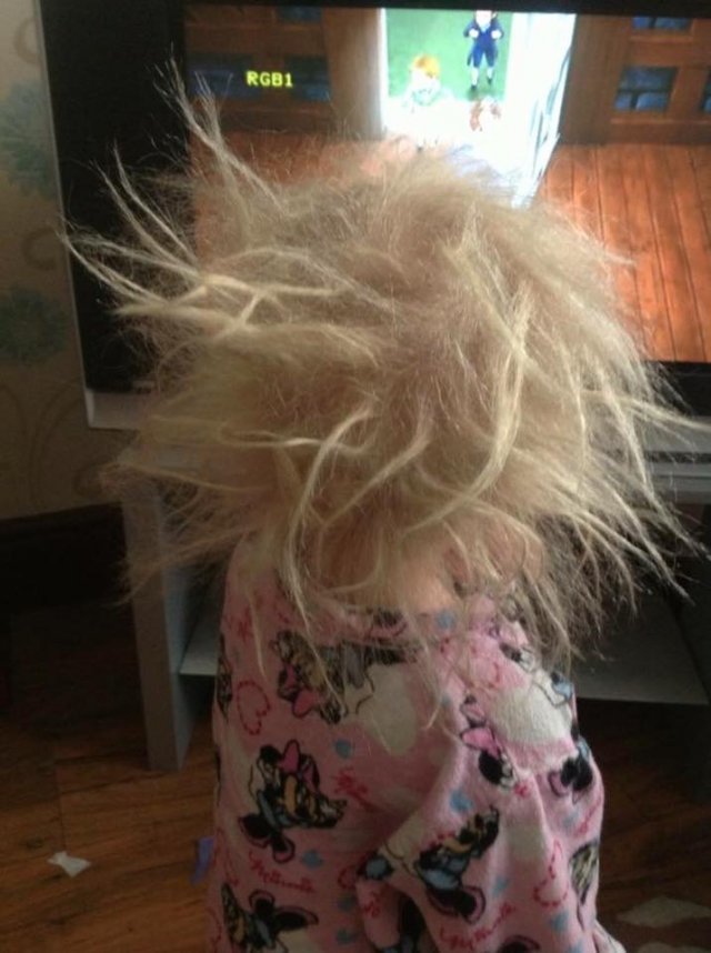 영국의 라일라 그레이스 발로는 불치병인 ‘엉킴 털 증후군(Uncombable hair syndrome)’을 앓고 있어 남들과는 다른 머리카락을 갖게 됐다. 사진출처 | 라일라 페이스북