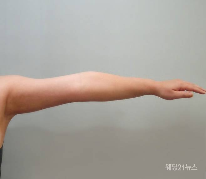 사진 : 약손명가코스메틱 바디 슬리밍 핫 크림 사용 후.