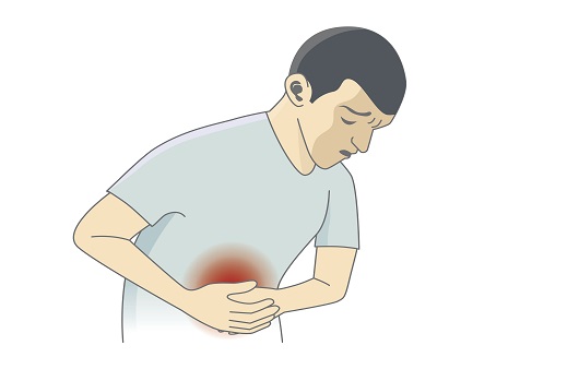 과민성대장증후군