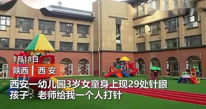 '바늘 자국이 29개라니' 중국 유치원서 여아 학대 논란 [웨이보 캡처.재판매 및 DB 금지]