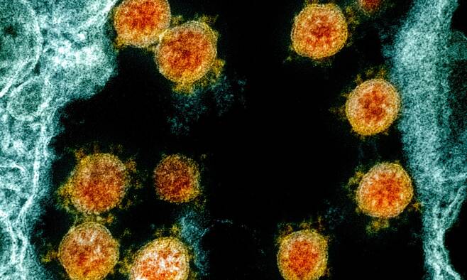 인체에 감염된 코로나 바이러스(주황색)의 전자현미경 사진. 최근 영국에서 돌기(스파이크) 단백질이 달라지면서 전염력이 세진 변이 바이러스가 급증해 새로운 대유행의 전조라는 우려가 나온다./NIAID