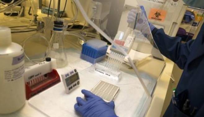 미국 한 실험실에서 항체를 찾기 위한 임상실험을 하고 있다. AFP/연합뉴스 제공