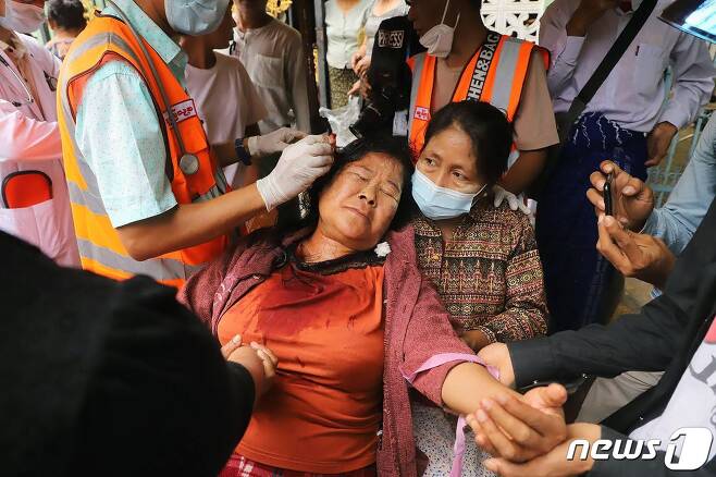 20일(현지시간) 미얀마 만달레이에서 군사 쿠데타를 규탄하는 시위대가 군경의 폭행으로 다친 머리를 의료진의 치료를 받고 있다. © AFP=뉴스1 © News1 우동명 기자