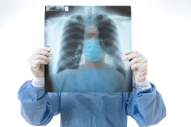 기흉은 폐 속 공기가 폐 밖으로 새어나오면서 폐를 수축시키는 질환이다./사진=클립아트코리아