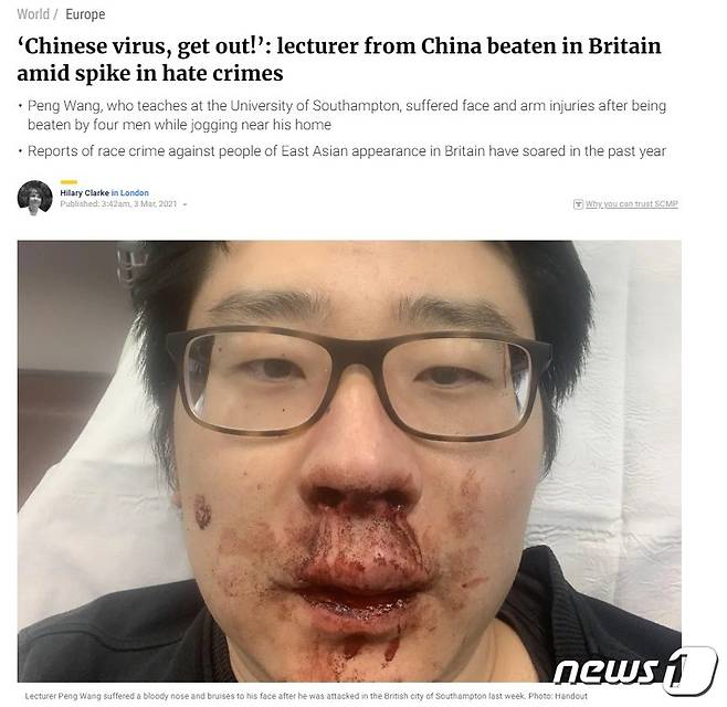 지난 23일(현지시간) 영국 사우스햄튼대학 중국인 강사 펑왕(37)이 대낮에 백인 남성4명에게 폭행을 당한 사실 보도한 사우스차이나모닝포스트(SCMP)갈무리© 뉴스1