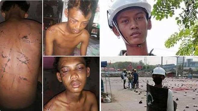 군경에 체포된 뒤 얼굴과 온몸이 상처투성이가 된 청년