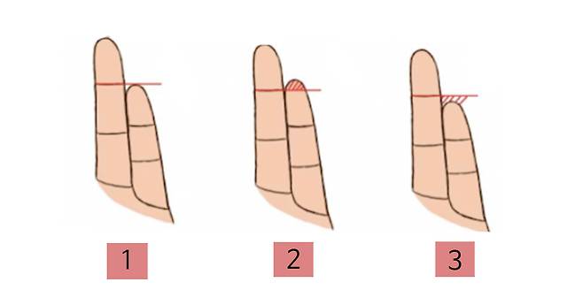 출처: 내 손의 약지와 새끼손가락의 길이는?