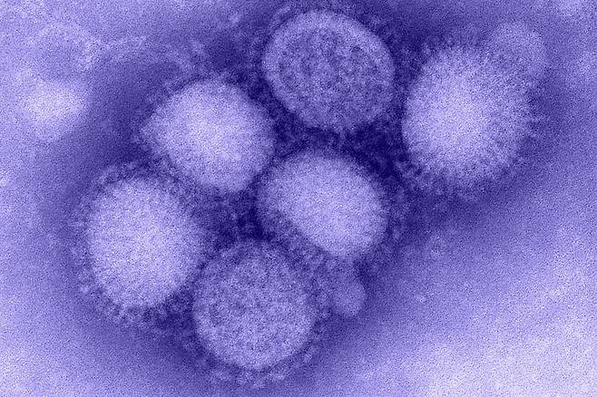 2009년 신종 플루 대유행을 부른 H1N1 인플루엔자 바이러스의 전자현미경 사진./CDC
