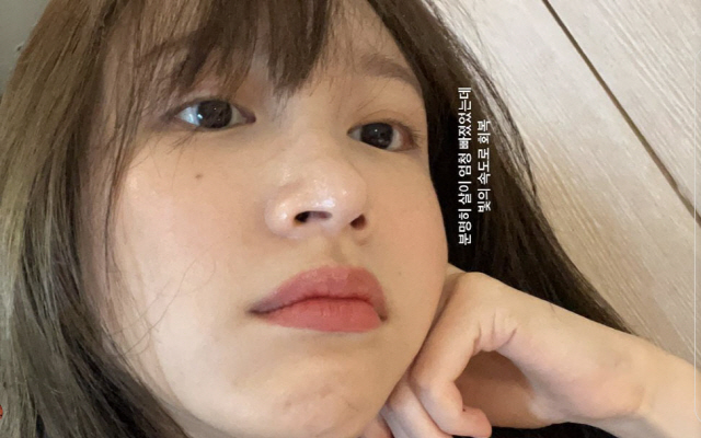 Actor Hani (Ahn Hee-yeon), a former EXID member of the group, reported on the recent situation after the COVID-19 cure.Hani posted a picture of his current situation through his instagram on the 6th.The photo shows the daily life of Hani, who is taking a selfie, staring at the camera with his chin in one hand.Close-up, boasting the beauty of the white skin, the lovely charm attracts attention.Obviously, I lost a lot of weight, but Im recovering at the speed of light, Hani added.Hani had been diagnosed with Corona on the 20th of last month and had been treated according to the guidelines of the health authorities.So, Hani said through his SNS, Thank you for your concern, I am okay now!Meanwhile, Hani is set to appear in JTBCs new drama Idol: The Coop, which is scheduled to air in the second half of this year.