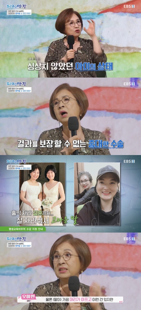 In EBS1s Life Story Blue Manjang (hereinafter referred to as Blue Manjang) broadcast on the 19th, Actor Oh Mi-yeon was subjected to a big Acid in the past four months of pregnancy, and later, the Orogeny daughter suffered a great deal of pain.On the day, Oh Mi-yeon appeared and said that the drunk driving vehicle was Acided by the invasion of the central line.At that time, the nurse at the Hospital was injured so much that she could not recognize her face completely. Oh Mi-yeon surprised everyone at that time.When the nurse saw her eyes open, she said, From her forehead, all the flesh went up.I had to operate in 24 hours, but I was told to go to a big hospital because it was a small hospital in the neighborhood. Oh Mi-yeon, who went to the big hospital, said he had a big injury, including ribs, left wrists and leg fractures.From 6 am to 1 pm, Oh Mi-yeon, who had undergone a face surgery for 7 hours, was not able to perform general anesthesia.Oh Mi-yeon, who was in the 4th month of pregnancy at the time, said, The baby was born, so the child was the most worried. I was sutured after partial anesthesia.It was a hard operation to tear the skin so much that I had to attach it to the skin, but I met a plastic surgeon who was on duty. Oh Mi-yeon, who had to be hospitalized for six months as an Acid, said he was in a pregnancy and could not operate on his injured legs.Oh Mi-yeon said, In order to perform leg surgery, I had to give up my child because I had to have a general anesthesia.I can not do Actor because my face is broken. Oh Mi-yeon, who decided to save the child and limp his legs, said that he recovered without surgery with the help of a doctor.Even in her efforts, the child confessed that she had been Orogeny in seven and a half months, and it was a pity for everyone.After giving birth, Oh Mi-yeon said, Its been about three weeks, but the nurse gives the child back, but the child has a big eye and head, so it was like ET. He said he had a hydrocephalus disease.Oh Mi-yeon, who decided to undergo surgery, said that the child had been diagnosed with a hollow brain and suffered a series of frustrations.Oh Mi-yeon said that she tried to give up her child but her husband could not give up because she could not guarantee her health and could have a disability.My husbands decision said that the child was undergoing surgery and that he was growing up well.Currently, Ohs daughter is married and has a happy day.Photo: EBS1 broadcast screen