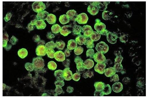뇌 먹는 아메바인 ‘파울러자유아메바’(Naegleria fowleri)의 현미경 사진. 사진 위키피디아