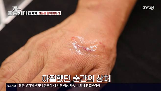Broadcaster Lee Kyung-kyu was bitten by domestic violence dog Beagle FloorLee Kyung-kyu met Floor, a problem dog, on KBS 2TV Dogs Are Incredible broadcast on August 23rd.Floor gave Lee Kyung-kyu a powerful bite during filming, with the owner worried: You all right, youre bitten hard.Lee Kyung-kyu was greatly embarrassed but said it was fine: There was a clear scar on the back of Lee Kyung-kyus hand.Kang Hyung-wook  also could not hide his worried expression.Lee Kyung-kyu said: When you go up to the situation room, you have drugs. You have to show them to the filming team. You have to insert. Then Ill go up.I was almost sane today, said Jang Doyeon, who smiled late and was treated for disinfection and other treatments.I cant even say it hurts because my mother is here, Lee Kyung-kyu said.As soon as I got out of the house, I was (screaming), Jang Doyeon revealed, prompting Lee Kyung-kyu to laugh.Jang Doyeon asked, Ill be fine, and Lee Kyung-kyu smiled bitterly, saying, Im not going in now, Im going to stay away from the dog.