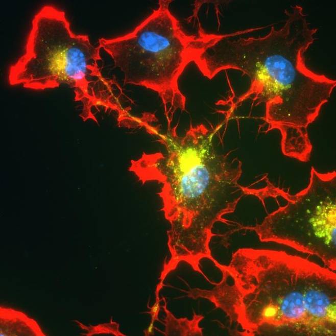 소교세포의 분업 메커니즘 소교세포의 핵(청색)이 튜브형 돌기(적색)로 연결돼 있다.
이런 네트워크는 독성 단백질을 분해하는 분업에 유리하다. 
[본 대학 미하엘 헤네카 교수 / 재판매 및 DB 금지]