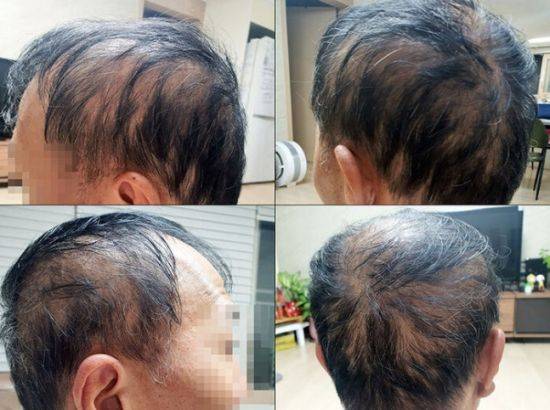 사진=청와대 국민청원 캡처