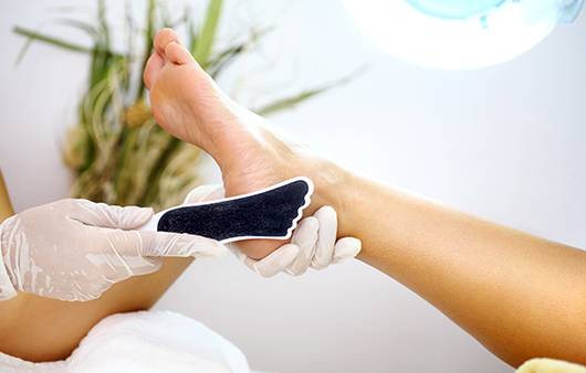 미용을 위해 각질을 제거하다가 무좀이 전염, 확산되기도 한다