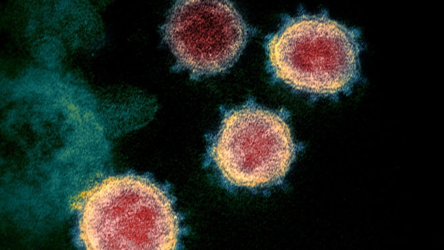 - 전자현미경으로 본 코로나19 바이러스의 모습., NIAID, CC BY 2.0 , via Wikimedia Commons