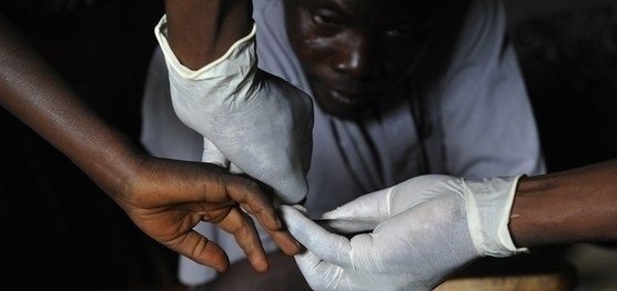 아프리카 중부 케냐 호마베이에 사는 한 에이즈 환자의 모습. 이 지역 내 에이즈 사망률은 큰 사회적 문제다. [AFP=뉴스1]