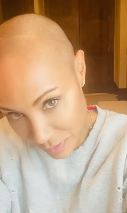 Hollywood actor Jada Pinkett Smith, 50, is becoming candid about her hair loss.Jada Pinkett Smyths, who Confessions said she suffered from alopecia (an autoimmune disease that causes hair loss) in 2018, posted a recent news story with fans on official SNS video on Friday.I have to laugh now, he said in the video, pointing at the clear faint line on his head with his hand, which does not have any hair at all.One day, it just came out of nowhere, he said of this.I have already said that I am suffering from alopecia.Look at this line right here, he said. Now I thought it would be a little harder to hide, so I just thought about going to go to you with you. Jada Pinket Smyths, who boasts a hairy head, also showed a positive aspect by posting Me and this alopecia will be friends!He first spoke about his worries about hair loss on the 2018 talk show Red Table Talk, which he said: At first I was scared.One day I was in the shower and I had a handful of hair in my hand. I was literally afraid. Then, in June, he decided to shave.Jada Pinket Smyths, meanwhile, is also famous for living with her husband, Hollywood actor Will Smyths, 53, as an open marage.Jada Pinquet Smyths is a sea where she had an affair with 21-year-old singer August Alsina in the past, when August said: People dont know the truth.I sat down with Will and shared the right thing, and their relationship changed from a couple to a life partner, and they allowed me to have a relationship with them. In this regard, Will Smyths told GQ, We gave each other trust and freedom with the belief that everyone should find their own way.And for us, marriage can not be a prison, he said of his marriage, Jada never believes in conventional marriage.Jada had a family with an unconventional relationship.She grew up in a very different way than the way I grew up, he said, telling me why the couple wanted to break away from the traditional way of marriage.Jada Pinket Smyths Instagram