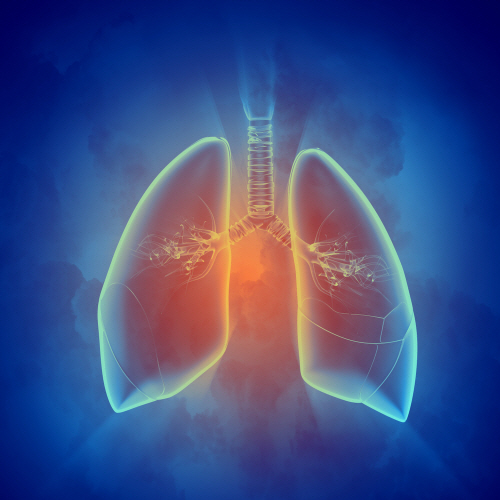사르코이드증의 약 90%는 폐에서 생긴다. 폐 침범 위치에 따라 마른기침, 호흡곤란, 흉통 등 천식과 비슷한 증상이 나타나기도 한다./클립아트코리아 제공