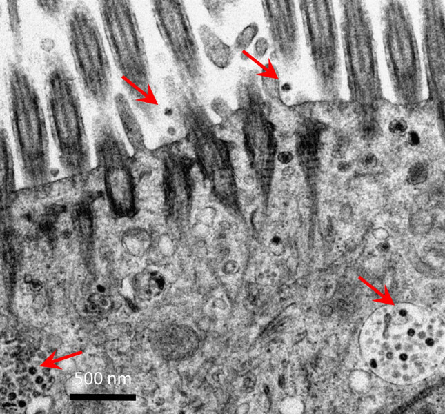 오미크론에 감염된 기관지 조직의 전자현미경 사진. 화살표가 가리키는 것이 바이러스 입자다. 홍콩대 의대 제공