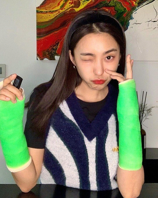 Purple posted a picture on his instagram on the 15th without any comment.The photo shows Purple winking with a cast on both arms. The beauty of the eyes attracts the attention of the viewer with a clear eye.Earlier, Purple revealed the shocking recent situation of singer Purple (Yoon Purple), who is from Loop Sistar, as a double-armed cast.Purple surprised fans by appearing on the live broadcast with dancers Honey Jay (Jung Ha-nui) and YGX Kim Hee-yeon on the YouTube channel Holly Bang Archive on the 9th.Ive been hurting both wrists for a month now, and Im feeling better now, he told fans, dont walk on the street and do your cell phone.Purple, meanwhile, is appearing in the JTBC drama Only One Person.Only one person is a human melodrama in which three women who met at the hospice come to face a real precious one person in life after trying to take only one bad person before she died.Photo Purple Instagram