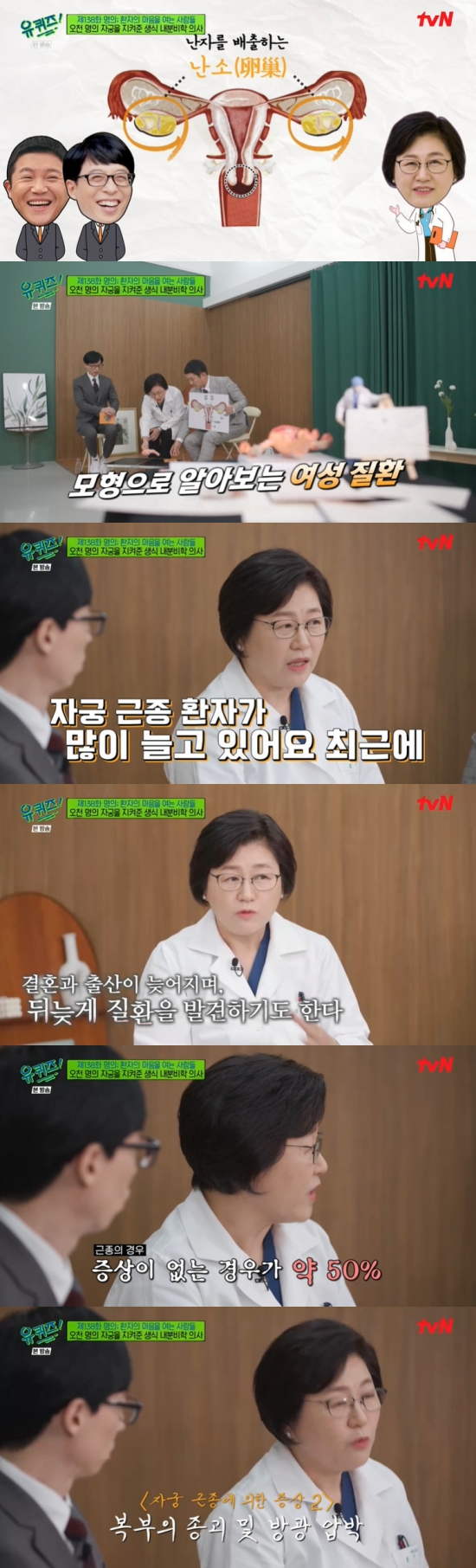 On TVN You Quiz on the Block (hereinafter referred to as Yu Quiz), which was broadcast on the 19th, the scene where Professor Kim Mi-ran appeared as a guest was broadcast while featured in The Name: People Opening the Heart of the Patient.Yoo Jae-Suk said, Both of them are men, so I was worried about what to do about the explanation today.Yoo Jae-Suk said, We also have to know these things through the professor because we have to go to the hospital if there is a job like Na Kyung-eun in the case of me because Yu Quiz is a program to listen to various people in various fields.Professor Kim Mi-ran explained the reproductive organs using the pictures and models prepared in advance, and said, The number of patients with uterine myoma is increasing.It seems that menarche is getting faster and exposure to female hormones begins early. Professor Kim Mi-ran explained, Many women are married late, have late births, and when they try to give birth, they have been tested for marriage.The problem is that there are about 50% of cases without symptoms. They say that the tummy has come out. It is quite big enough to touch a large myoma, Kim said.Yoo Jae-Suk wondered, What symptoms are there? Professor Kim Mi-ran said, It can cause excessive menstruation or menstrual pain.If this grows, I will often pee and if it gets too big, the boat will come out. Professor Kim Mi-ran said, Some people say that they learned later after dieting. If you do not do ultrasound, you can not know if there is a bump.If you are a college student, it would be nice to try it once during vacation. What happens when you pass without knowing these diseases, said Yoo Jae-Suk, who said, it causes infertility. Physiology is also enormous.I will just endure a lot of menstruation. Anemia is getting very severe. In particular, Yoo Jae-Suk asked, There was a belief that I decided when I chose obstetrics and gynecology. Professor Kim Mi-ran said, It was during the Internet.In the old days, I had a lot of babies. The Intern had babies. They were all sleeping at dawn.I had to give the baby to the nurse quickly and go back to the mother, but she didnt let me go.Since then, I have become a doctor, but I have a sincere idea that I will contribute to the health of women by protecting my precious womb. Photo = TVN broadcast screen