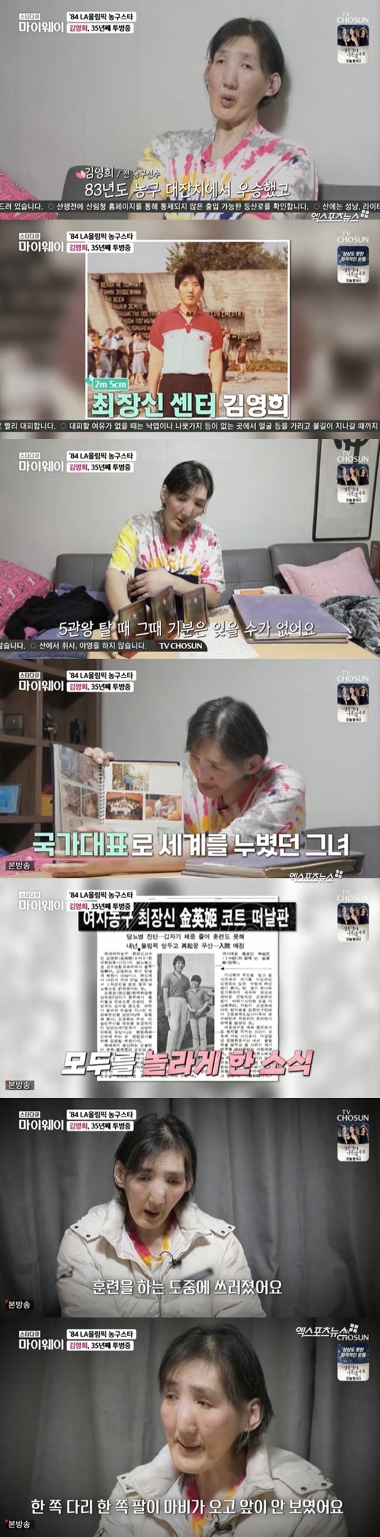 My Way Kim Yeong-hee mentioned the past that got sick.TV CHOSUN star documentary myway broadcasted on the 6th appeared in the basketball legend Kim Yeong-hee, who made a mark in the history of Korean womens basketball in the 80s.Kim Yeong-hee is 2m 5cm tall and played a leading role in the 1984 Los Angeles (LA) Olympic silver medal.However, during his prime, he was diagnosed with a rare disease called malline hypertrophy. He was rapidly worsened by a cerebral hemorrhage and suddenly left the court without a retirement game.The complications that I got while fighting the illness made my behavior uncomfortable, and it was difficult to move from the room without help from someone.He said: I won the basketball grand prix in 1983 and won five titles: I won the scoring, rebound, Yatu shot rate, the best, and the popularity.It was said that the elephants that were broadcast in the newspaper turned into elephants that carried them. It was a good time for me, even though I was strong. Kim Yeong-hee said, I trained in the athletes village for the 88 Seoul Olympics, and I fell down while training, and I was paralyzed, one leg, one arm paralyzed and I could not see.He went to a designated hospital and had a big bump on his head, and he was sentenced to death if he had trained a little more.I told him to choose between death and exercise. Photo: TV CHOSUN broadcast screen