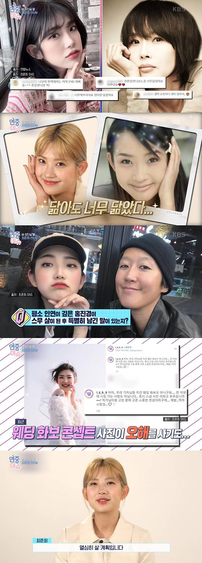 Actor late Choi Jin-sils daughter Choi Joon-Hee has revealed that lupus disease has not been cured.Choi Joon-Hees interview was broadcast on KBS2 Year-round live broadcast on the 11th.Choi Joon-Hee, who was born in 2003 and turned 20 this year, laughed brightly, saying, It is good that you can buy colorful drinks that you see every time you enter a convenience store as a private certificate (resident registration card).He also said that he and his brother Choi Hwan-hee (JiPlat) usually think of the broadcaster Jin-kyeong Hong as a mother, and recently Jin-kyeong Hong said, I am 20 years old and I want to cope more maturely.Choi Joon-Hee added: Precisely call me and say, Always my aunt is praying for Junhee.Choi Joon-Hee has gained weight to 96kg due to a battle with lupus disease, but lost 44kg and collected a big topic.I went to the fitting room and put on my pants, but I did not raise my pants so that I could get red, but I did not wear it anyway.I just took off and cried a lot. I got lupus disease in my middle school, but there is no concept of cure, and I am still taking medicine, and I have increased my weight because of it.I ate a lot because of the side effects of the medicine, he added.Choi Joon-Hee said, I want to follow my mothers picture. Choi Jin-sils photo was released. I take pictures of this style a little often.I have to shoot it, so I have to raise my eyes.  I do not have a youthful mother. I have to sweep my temples. Choi Joon-Hee said, I am not sure yet that you think you will be following your mother.I want to try the cafe, and I am interested in dog beauty and makeup. I still want to do so, so I feel sorry to have to choose one job. Choi Joon-Hee also said, I did not live a long life, but I think I have been through a lot of work in the movie for 20 years, so I am preparing a prose book containing what I learned and what I felt at my point of view.Sometimes it is said that every move is a burden. Sometimes ordinary friends are envious. (SNS) I look exaggerated if I raise one.It was a little bit tough in my school days, she said.Finally, Choi Joon-Hee said, It is not an exaggeration to say that my mother gave birth and the public raised it.I look forward to my mothers share and look at her with a lot of love, and my brother and I plan to live hard enough to think that my mother and uncle are cool when they see them in the sky. 