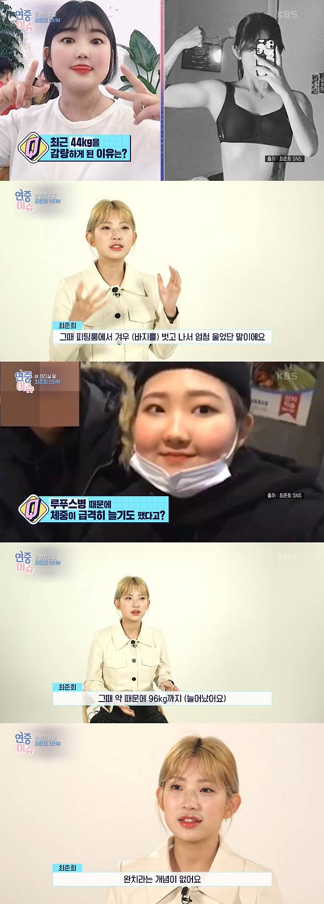Actor late Choi Jin-sils daughter Choi Joon-Hee has revealed that lupus disease has not been cured.Choi Joon-Hees interview was broadcast on KBS2 Year-round live broadcast on the 11th.Choi Joon-Hee, who was born in 2003 and turned 20 this year, laughed brightly, saying, It is good that you can buy colorful drinks that you see every time you enter a convenience store as a private certificate (resident registration card).He also said that he and his brother Choi Hwan-hee (JiPlat) usually think of the broadcaster Jin-kyeong Hong as a mother, and recently Jin-kyeong Hong said, I am 20 years old and I want to cope more maturely.Choi Joon-Hee added: Precisely call me and say, Always my aunt is praying for Junhee.Choi Joon-Hee has gained weight to 96kg due to a battle with lupus disease, but lost 44kg and collected a big topic.I went to the fitting room and put on my pants, but I did not raise my pants so that I could get red, but I did not wear it anyway.I just took off and cried a lot. I got lupus disease in my middle school, but there is no concept of cure, and I am still taking medicine, and I have increased my weight because of it.I ate a lot because of the side effects of the medicine, he added.Choi Joon-Hee said, I want to follow my mothers picture. Choi Jin-sils photo was released. I take pictures of this style a little often.I have to shoot it, so I have to raise my eyes.  I do not have a youthful mother. I have to sweep my temples. Choi Joon-Hee said, I am not sure yet that you think you will be following your mother.I want to try the cafe, and I am interested in dog beauty and makeup. I still want to do so, so I feel sorry to have to choose one job. Choi Joon-Hee also said, I did not live a long life, but I think I have been through a lot of work in the movie for 20 years, so I am preparing a prose book containing what I learned and what I felt at my point of view.Sometimes it is said that every move is a burden. Sometimes ordinary friends are envious. (SNS) I look exaggerated if I raise one.It was a little bit tough in my school days, she said.Finally, Choi Joon-Hee said, It is not an exaggeration to say that my mother gave birth and the public raised it.I look forward to my mothers share and look at her with a lot of love, and my brother and I plan to live hard enough to think that my mother and uncle are cool when they see them in the sky. 