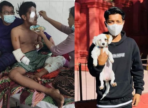 병원에서 가족들에게 치료를 받고 있는 ‘흘라잉 표 아웅(22)’. 가족들은 그가 치료도 마치기 전에 교도소로 이송됐다고 주장했다. 오른쪽은 쿠데타 이전 대학생이었던 ‘흘라잉 표 아웅’의 사진/ 미얀마나우 제공