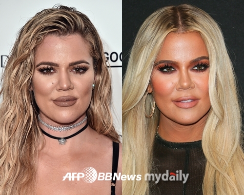 Global model Chloe Kardashian, 37, has shown satisfaction wIth nose surgery.He told ABC News on Thursday about the nose plastic surgery he had received in March 2019.Kardashian told host Robin Roberts, For my entire life I wanted to have a nose job, but It was in the middle of my face, and I was afraid to think about It.But I finally got the courage, and I did It. And I love my molded nose. After the broadcast, he also discussed his plastic surgery wIth fans on social media, wIth someone tweeting: Chloe has a nose job, my God.I got It a few weeks before my daughter Trus first birthday, Kardashian said.When another user pointed out that It was the worst recovery ever, he said, Stop It. Thats ridiculous. It was honestly so easy.My only regret is that I did not have nose surgery sooner. Meanwhile, Khloe Kardashians boyfriend, NBA star Tristan Thompson, 30, apologized to Khloe Kardashian after getting a son wIth personal trainer Marley Nichols.Suspicions were raised in 2018 that Tristan Thompson had an affair when Khloe Kardashian was pregnant, but she did not splIt.In 2019, when Tristan Thompsons cheating resurfaced, he broke up but reunIted.She had an affair wIth Marley Nichols and inItially denied that she was not her child when her son was born, but bowed when genetic testing revealed she was a son.Today, as a result of my paternIty, a child was born wIth Marali Nichols, he said in an Instagram story on January 3, I take full responsibilIty for my actions.Im looking forward to raising my son smoothly now that my fathers posItion is in place.I sincerely apologize to all those who have hurt or disappointed personally or publicly through this ordeal, he added.Tristan thompson is a great father, but he doesnt fIt me, Khloe Kardashian said.