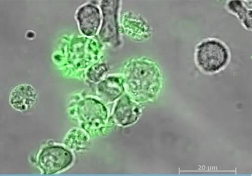 NK세포의 암세포 검문 암세포(녹색)의 존재를 면역계에 알리기 위해 외막 조각을 뜯어내는 NK(자연살해)세포.
[캐나다 오타와대 연구팀의 2022년 4월 13일 '사이언스 어드밴시스' 논문 캡처. 재판매 및 DB 금지]