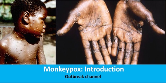원숭이두창 감염 사례 /세계보건기구(WHO) 홈페이지