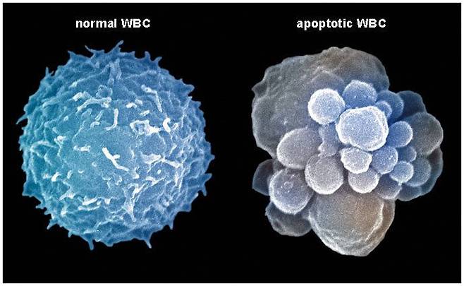정상 세포와 사멸한 세포를 비교한 그림. 왼쪽이 정상 세포, 오른쪽이 사멸한 세포./게티이미지